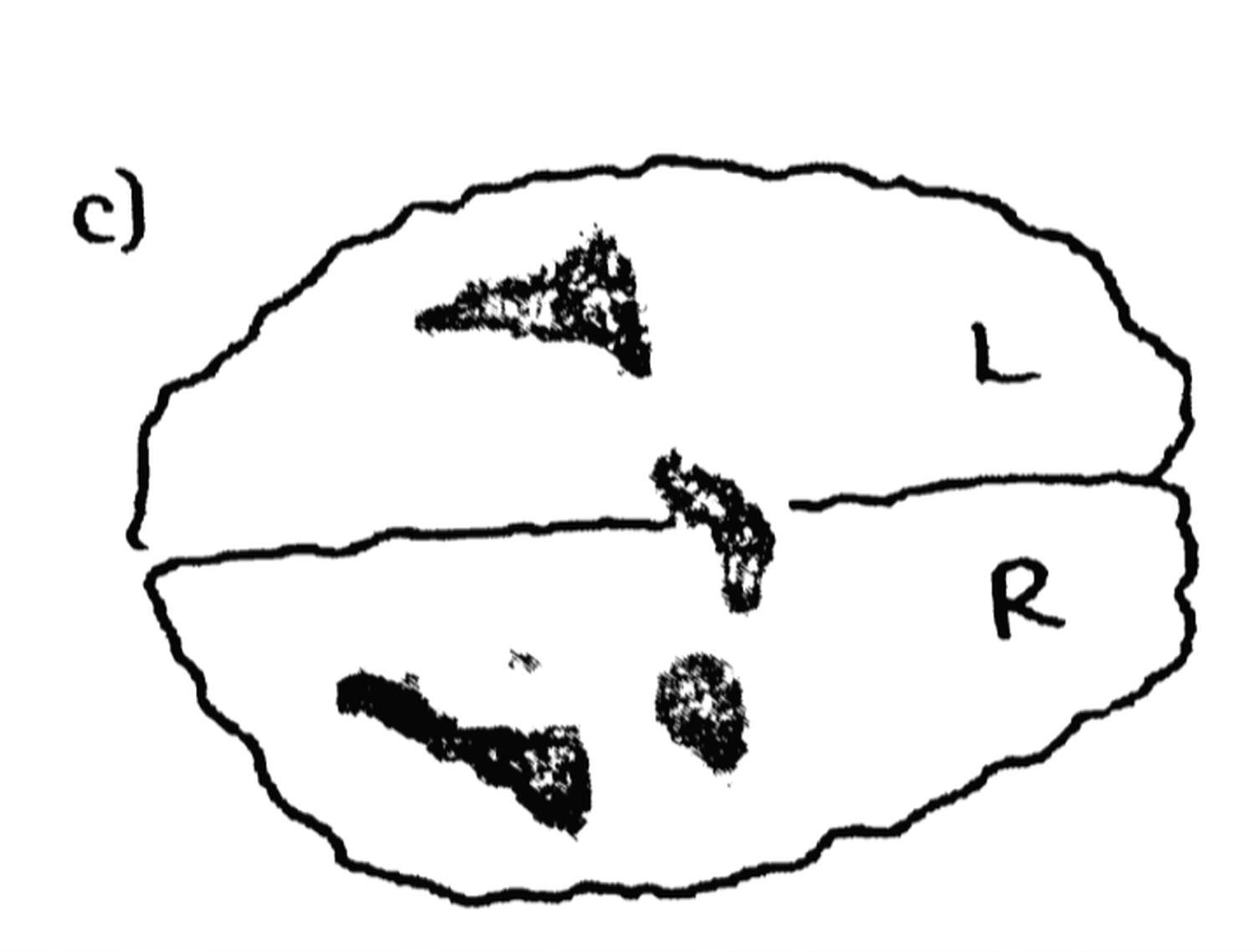 Linkshänder Beraterin Mandy Hartung – Gehirndiagramm von umgeschulter (unwissender) Linkshänder 